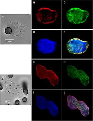 Intrinsic and Extrinsic Modulators of the Epithelial to Mesenchymal Transition: Driving the Fate of Tumor Microenvironment